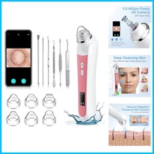USB Rechargeable Pore Vacuum with 1080P Camera & 3 Adjustable Modes - Light Pink
