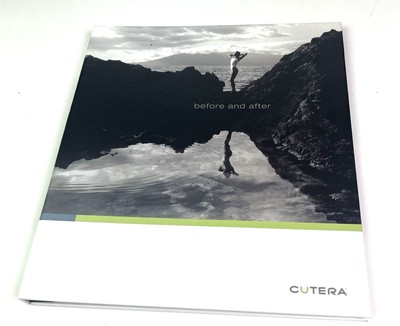 Cutera Laser Skin Treatment Before & After Marketing Binder