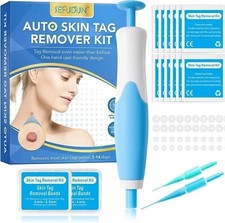 Auto Micro Skin Tag Remover Device Kit Safe Painless Removal 2-8 mm Band Tool