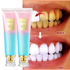 2X Natural Niacinamide Whitening Toothpaste Nicotinamide Dazzle White Toothpaste
