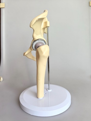 Artificial Shoulder replacement Anatomical model Knee Shoulder Elbow joint model - Picture 27 of 47