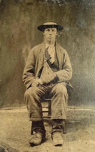 CIVIL WAR CONFEDERATE WOUNDED SOLDIER FROM BATTLE OF BIG BETHEL TINTYPE PHOTO