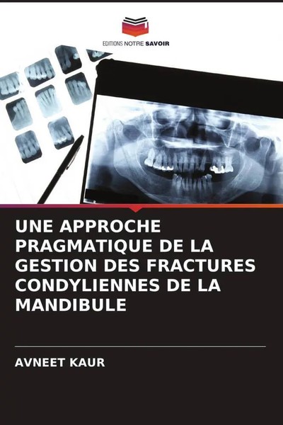 Avneet Kaur | UNE Approche Pragmatique DE LA Gestion DES Fractures...-image