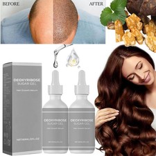 New Deoxyribose Sugar Gel Hair Growth, Deoxyribose Serum for Hair Loss 60ml