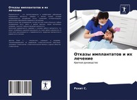 Otkazy Implantatow I Ih Lechenie Rohit S.