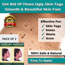2X NEW SKIN TAG REMOVER CREAM SAFE FAST WART REMOVAL MOLE ACNE PIMPLE PATCH SPOT
