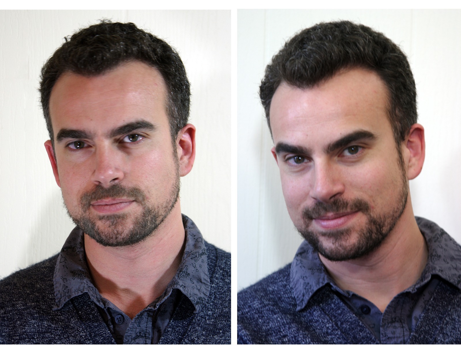 The Younger Looking Beard (Dark Brown) Beard Dye Breakthrough. 1 Minute