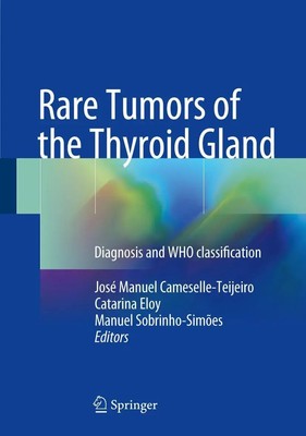 José Manuel Cameselle-Teijeiro (u. a.) | Rare Tumors of the Thyroid Gland | Buch
