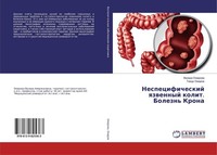 Nespecificheskij Qzwennyj Kolit. Bolezn' Krona Venera Omarowa
