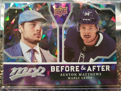 2021-22 Upper Deck MVP BEFORE & AFTER Austin Matthews  #BA-1 Maple Leafs