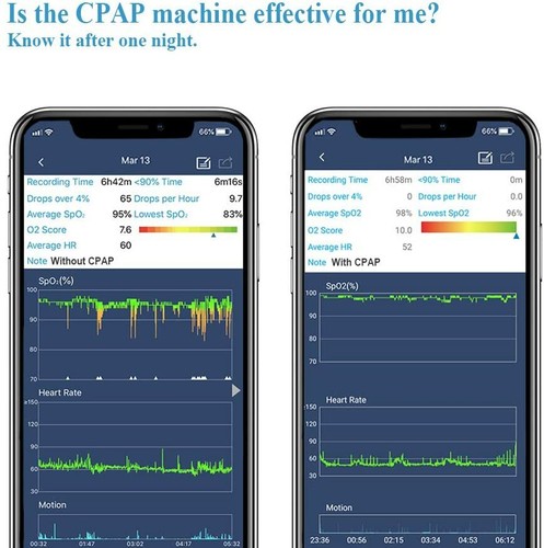 SleepU Wrist Oxygen Monitor-Sleep with Peace of Mind - Picture 4 of 16