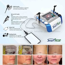 Smart Tecar Therapy Machine Cet Ret Pain Relief Physiotherapy Reduce Cellulite