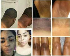 2X Skin Lightening Cream for Whitening Skin,dark Spot Face,body 15gm