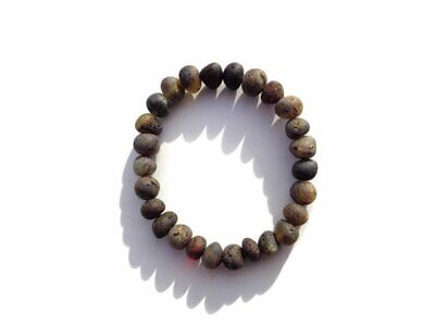 AstroRoot - Amber Gemstone Amber Bracelets are highly effective for  controlling the pain of rheumatism, arthritis, and aching muscles and  joints. #Amber #Bracelets #effective #rheumatism, #arthritis #muscles  #gemstone | Facebook