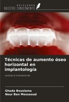 Ghada Bouslama (U. A.) | TéCnicas De Aumento óSeo Horizontal En ImplantologíA