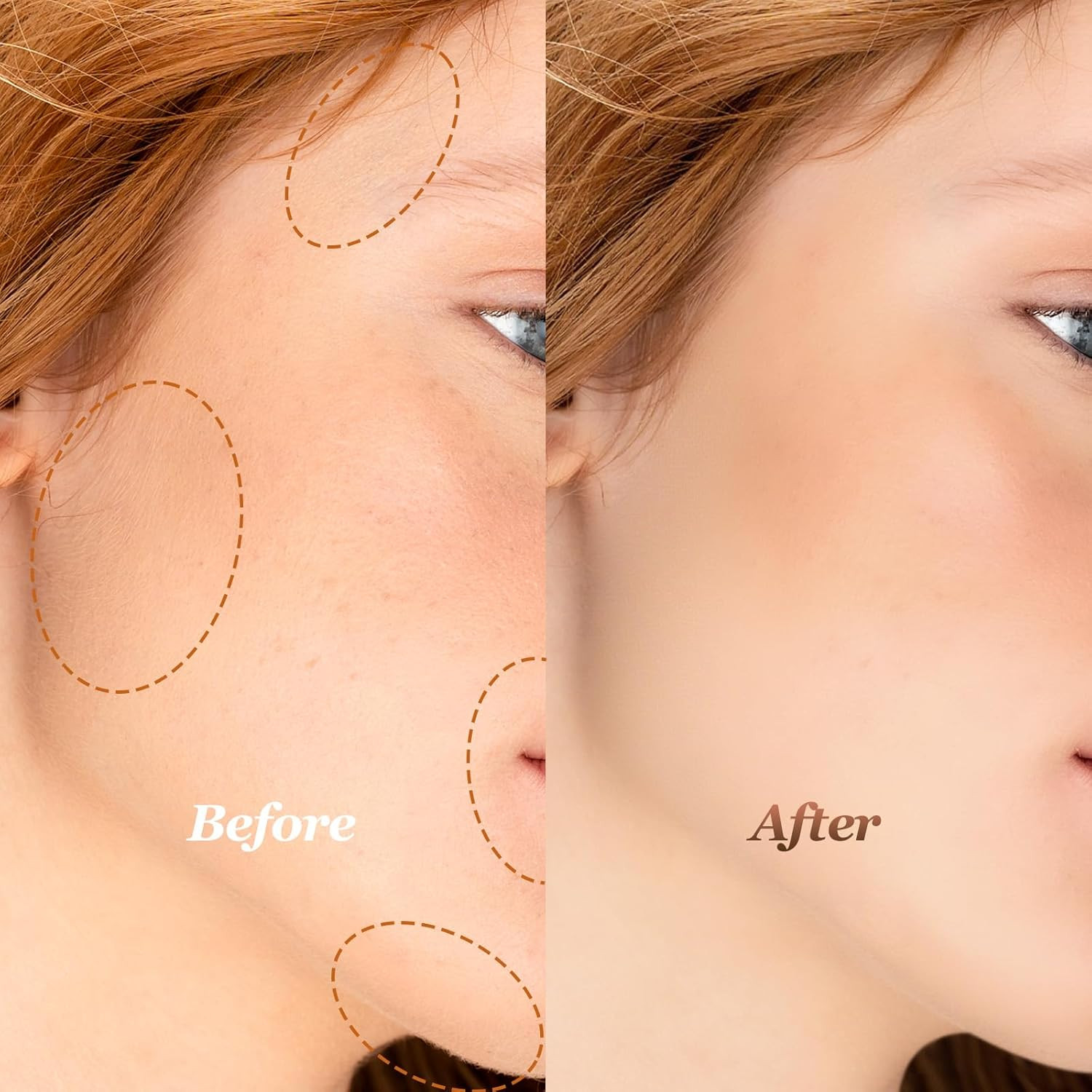 6Pack Facial Rose Gold Gen 3 Replacement Heads for Flawless Hair Remover Generat