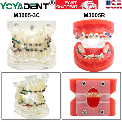 Dental Typodont Teeth Model Orthodontic Treatment Metal Ceramic BracketsRetainer