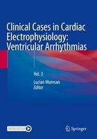 Clinical Cases In Cardiac Electrophysiology: Ventricular Arrhythmias Lucian Mure