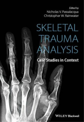 Nicholas V. Passalacqua Skeletal Trauma Analysis (Hardback) (UK IMPORT)