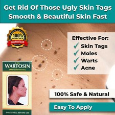 NEW SKIN TAG REMOVER CREAM SAFE FAST WART REMOVAL MOLE ACNE PIMPLE PATCH SPOT