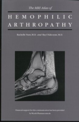 The MRI Atlas of Hemophilic Arthropathy [Paperback] Rachelle Nuss and Ray F. Kil