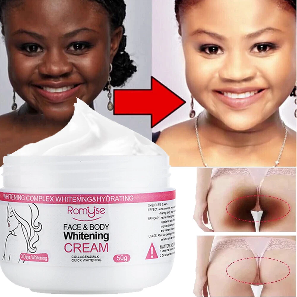 Skin whitening creams that work fast deals