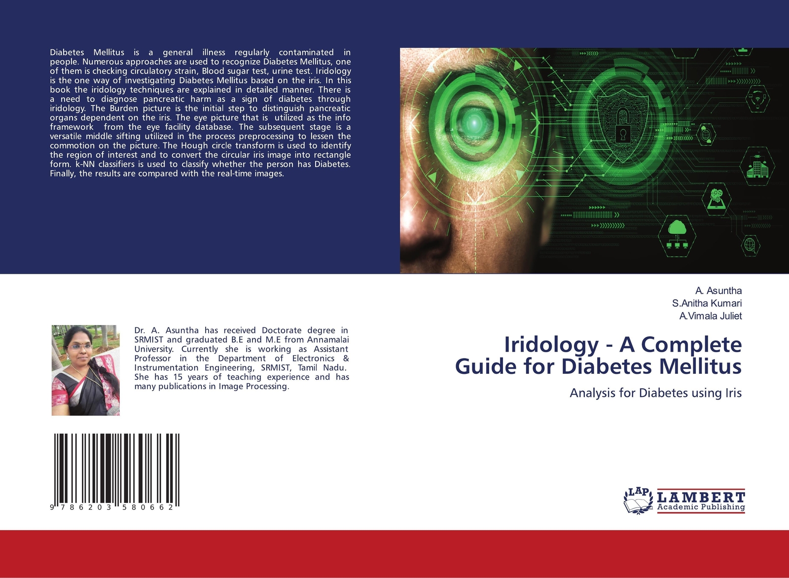 Thumbnail - Iridology - A Complete Guide For Diabetes Mellitus | A. Asuntha (u.