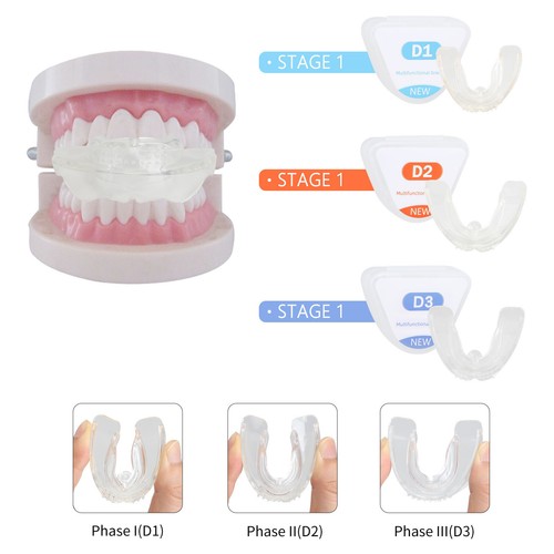 3 Stufen Dental Kieferorthopädische Zahnkorrektur Zahnspange Zahnhalter Richtwerkzeug - Bild 4 von 22