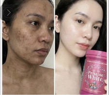 Satin Skinz Pristine White Supplement Skin beauty supplement 