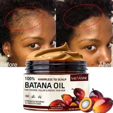 Batana Oil For Hair Growth Hair Loss Treatment Pure Natural Botana Oil Cream US