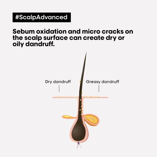 L'Oréal Professionnel Scalp Advanced Anti-Schuppen Dermo-Klärer Shampoo 300ML - Bild 2 von 4