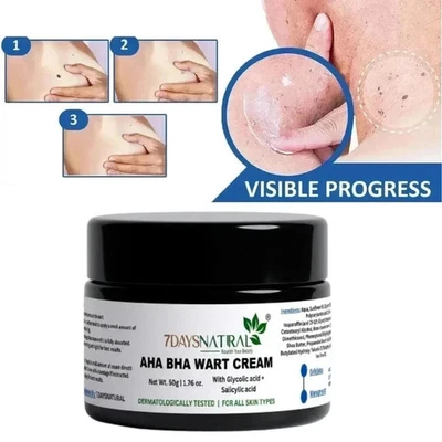 Crème antiverrues génitales 7 jours pour hommes et femmes 50 g - Photo 1/4
