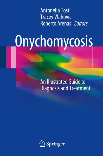 Onychomycosis Antonella Tosti-image
