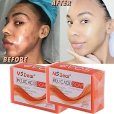 2PCS Kojic Acid Soap Acne Dark Spot Remover Skin Lightening Whitening Face Body
