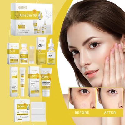 Acne Treatment Set for Face & Body, Blemish Control Acne Scars Treatment Kit