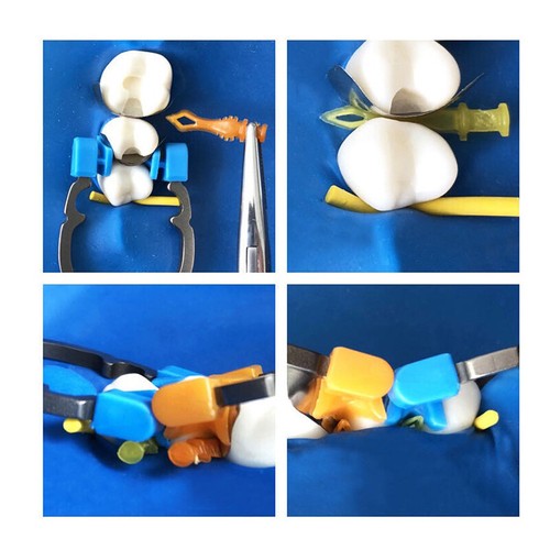 50 X CUNEI Parafango Dentale Parafango Interprossimale Matrice - Foto 12