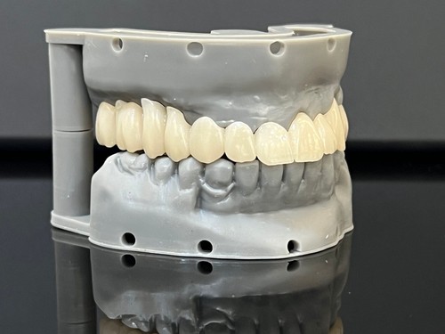 DLP SLA LCD 3d printer ALL ON X resin - for all on x cases, bridges,arcs, hybrid - 第 22/26 張圖片