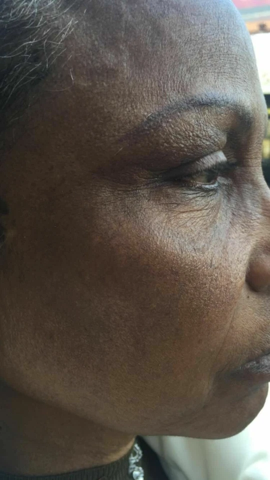 White Fade Super Skin Lightener Cream, Para Piel Triguena o Morena 2oz. - Image 2 of 4