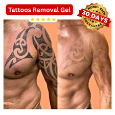 ORIGINAL Tattoo Removal Gel Painless Fade Ink Repair Damaged Skin FAST RESULTS