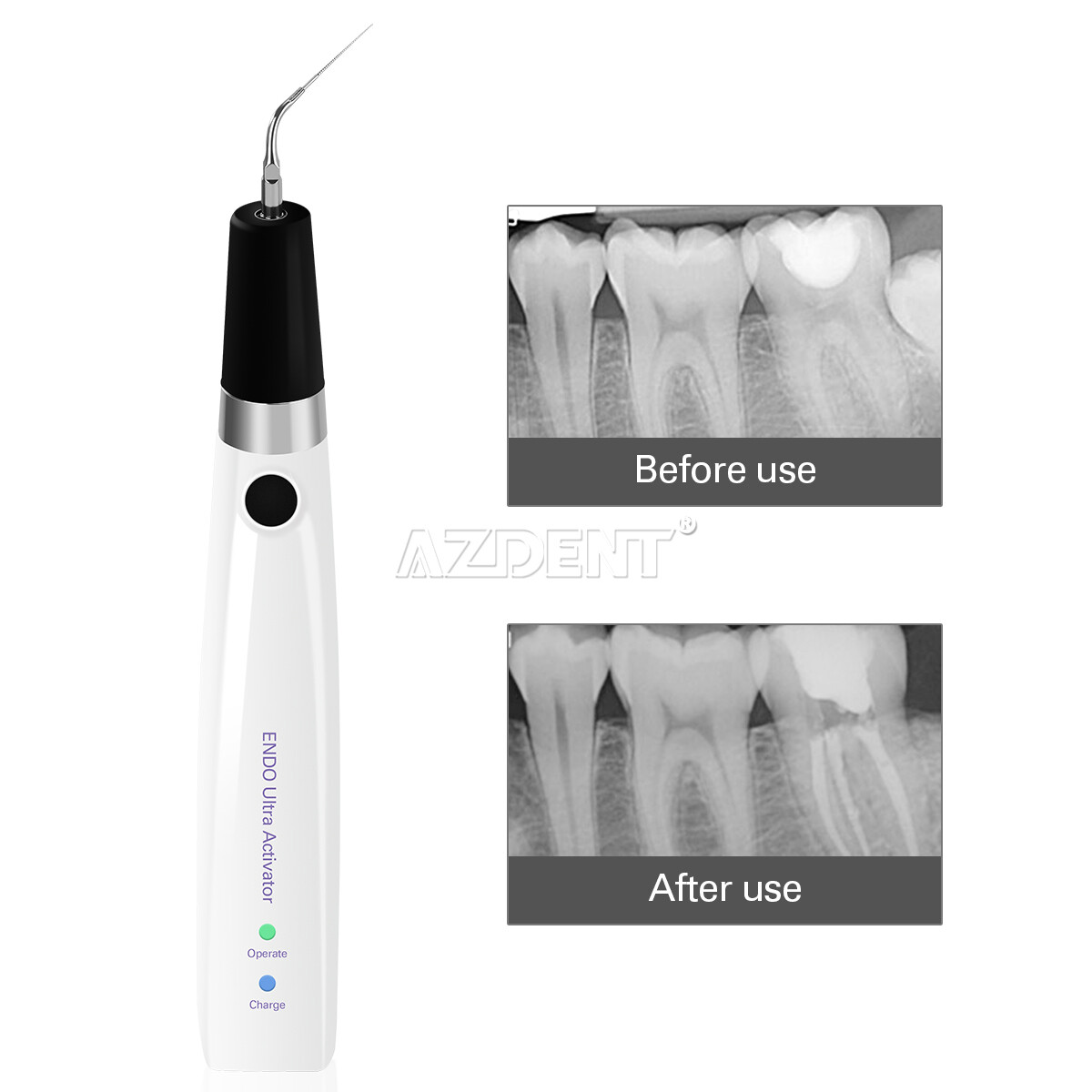 Dental Endo Ultra Activator Ultrasonic Irrigator Root Scaling Handpiece/ Tips
