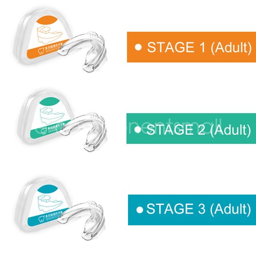 Dental Orthodontic Teeth Corrector Braces Tooth Retainer Straighten Adult Child - Picture 16 of 20