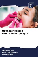Umar Makbul (U. A.) | Ortodontiq Pri Smeshannom Prikuse | Taschenbuch | Russisch