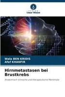 Wala Ben Kridis (U. A.) | Hirnmetastasen Bei Brustkrebs | Taschenbuch | Deutsch