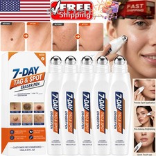 Picdo 7-Day Tag Spot Eraser Mole Skin Tags Removal Tool Eraser Pen Painless