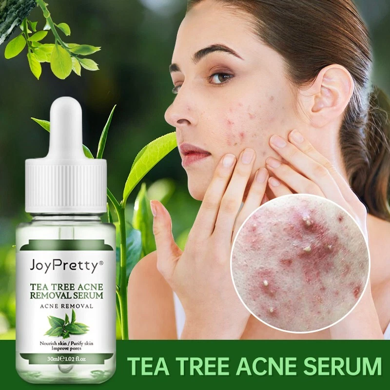 tea tree oil acne scars