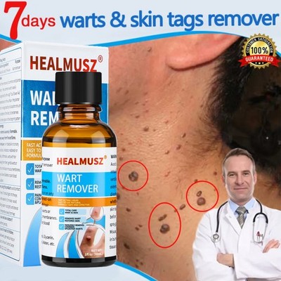 Wart Remover Liquid Skin Tag Wart Remover Eliminate Feet Corn Wart Remove Liquid