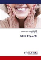 Tilted Implants Era Singh