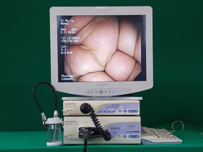 Olympus cv-160/clv-160/maj-1462/maj-843/maj-845/mh-966/maj-901 vs cv-180/EPK-i