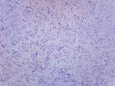 25PK Typical Bacteria - Prepared Microscope Slides, 75x25mm - Eisco Labs