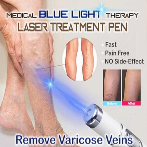 Blue Light Therapy Varicose Veins Pen - Soft Scar Wrinkle Removal New - UK - Picture 1 of 12